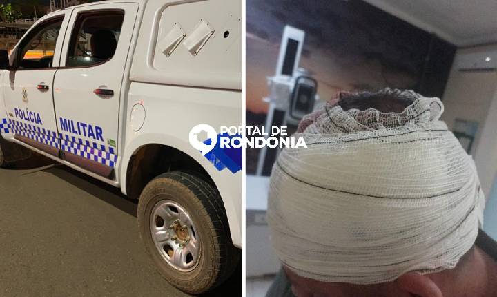 Homem é baleado na cabeça após suspeito sacar arma e dizer “aqui é CV”