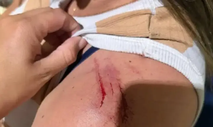 Mulher é espancada por ex-marido em Colorado do Oeste