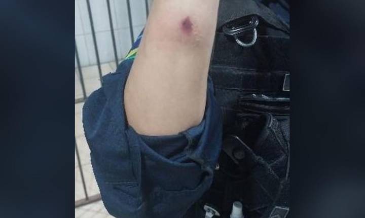 Policial Militar é atacado a mordidas durante registro de ocorrência na zona leste de Porto Velho