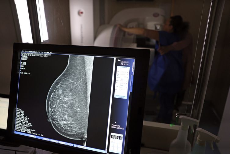 Câncer de mama: uma em cada três pacientes tem menos de 50 anos