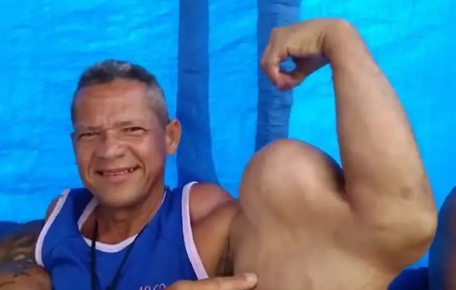 Arlindo Anomalia, o “Popeye Brasileiro”, morre aos 55 anos