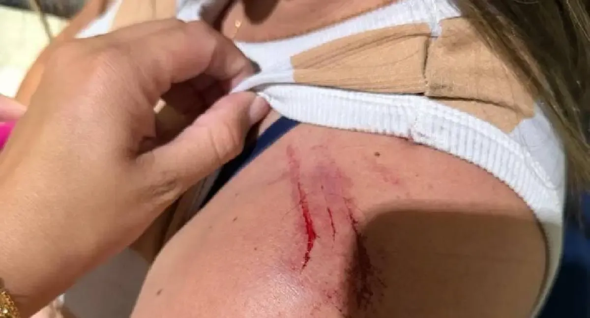 Mulher é espancada por ex-marido em Colorado do Oeste