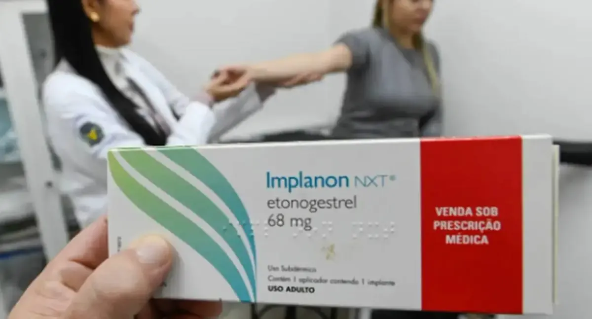 SUS amplia oferta de implantes hormonais com qualificação de profissionais