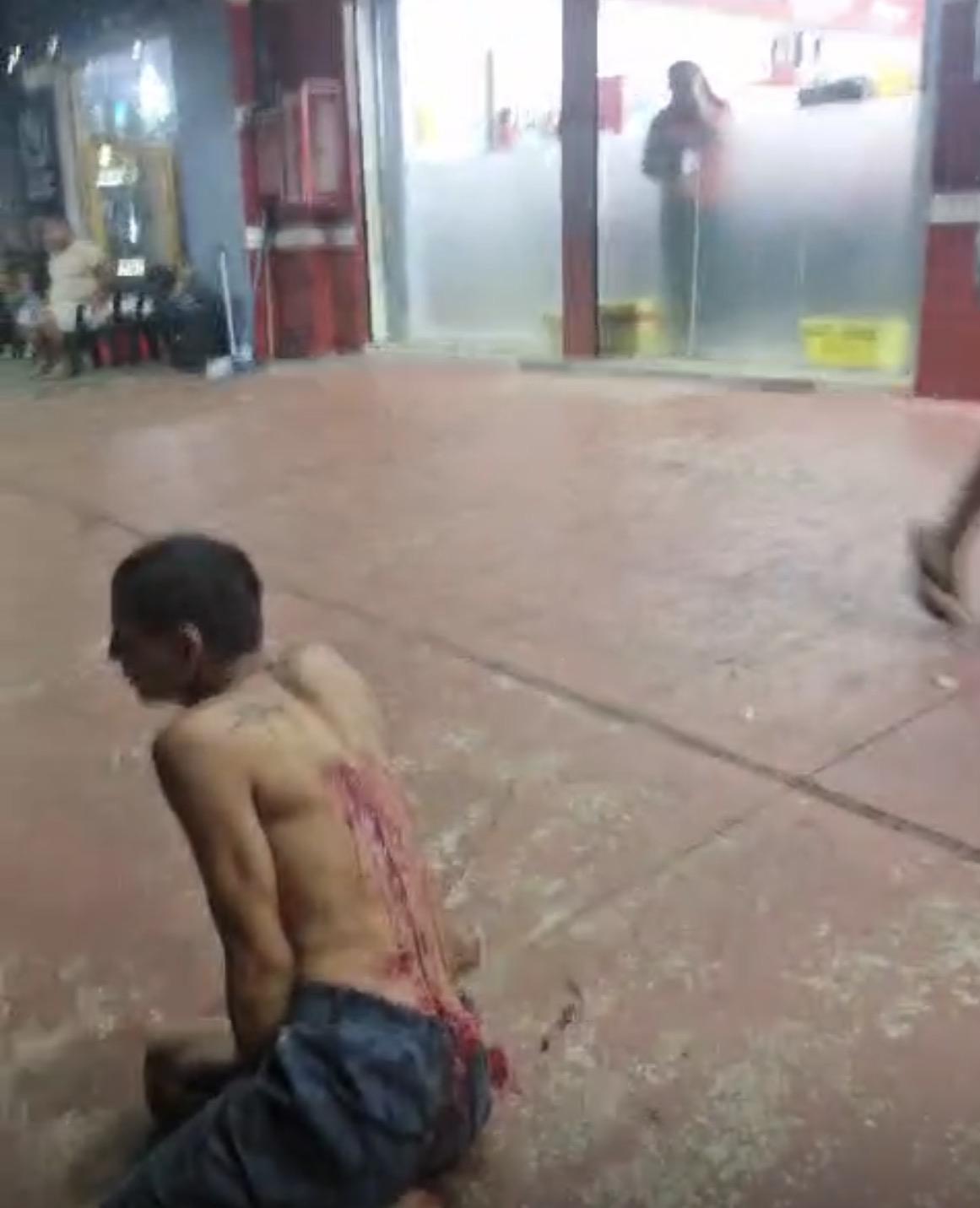 Malabarista venezuelano é esfaqueado no centro